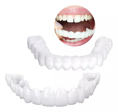 Dientes Postizos Carilla Dental Temporal Dientes de Quita y Pon Carilla de  Dentadura para Sonrisa de Confianza Diente Blanco Falso con Mini Pinzas  para Hombre Mujer Diente Malo (4 Piezas) : 