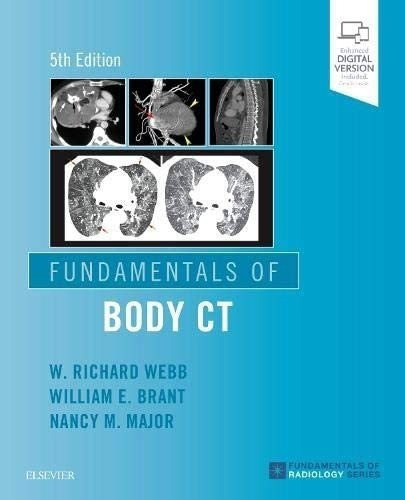Libro:  Fundamentals Of Body Ct (fundamentals Of Radiology)