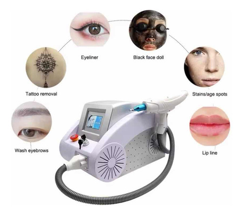 Laser Nd Yag Hollywood Peel Eliminar Tatuajes