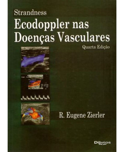 Strandness Ecodoppler Nas Doenças Vasculares