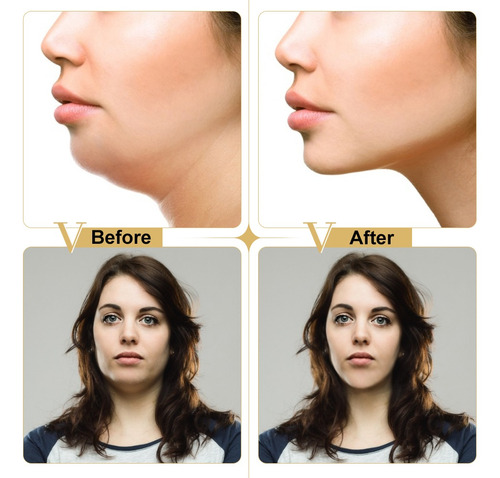 Mascarilla Tensora Reductora De Papada Y Contorno Facial