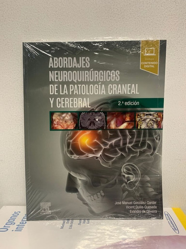 González. Abordajes Neuroquirúrgicos De La Patología Craneal Y Cerebral. 2ed., De González.. Editorial Elsevier, Tapa Blanda, Edición 2da En Español, 2020