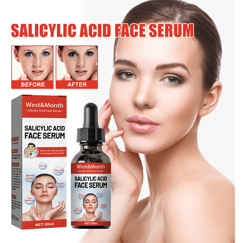 Ácido Salicílico Facial Reduz Manchas, Marcas, Encolhe Os Po