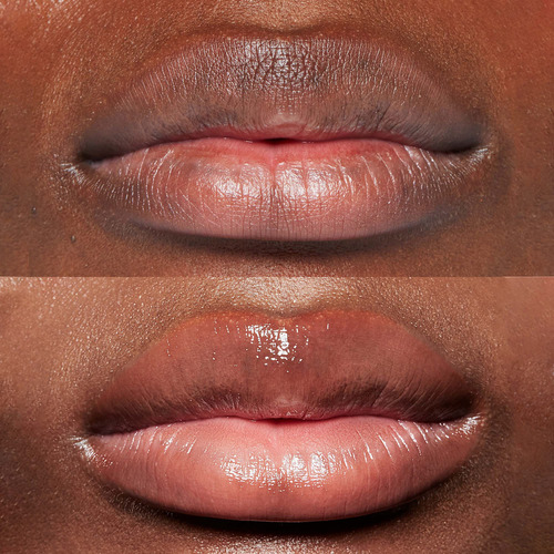 Tratamiento Para Dar Volumen A Los Labios My Instant Effects