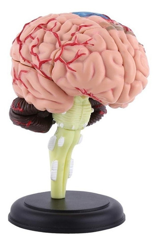 Cerebro Con Arterias Desarmable - Modelo Anatómico