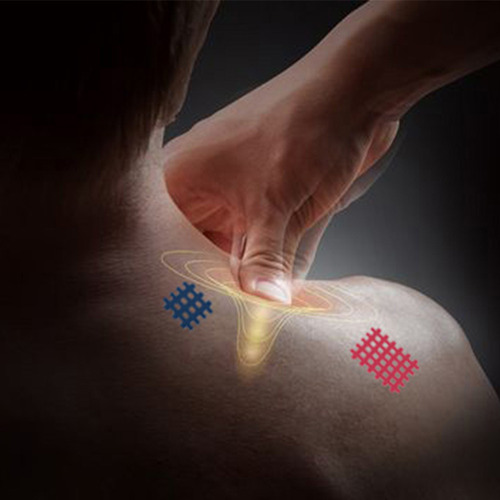 Fisioterapia De Rayón Con Cinta Muscular Elástica Deportiva
