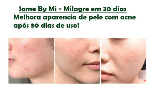 Some By Mi Acne Aha Bha Pha 30days Miracle Clear Foam 100ml Tipo De Pele Oleosa