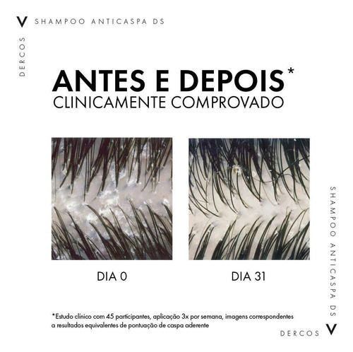 Vichy Dercos Shampoo Anticaspa Ds Cabelos Normais A Oleosos