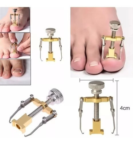 Herramienta Desenterrador Uñas Enterradas Encarnadas Uñeros
