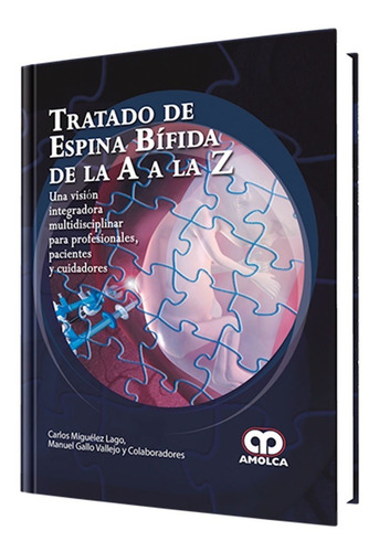 Tratado De Espina Bífida De La A A La Z.