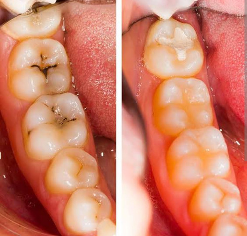 Brackets Para Ti, Corrige Tus Dientes