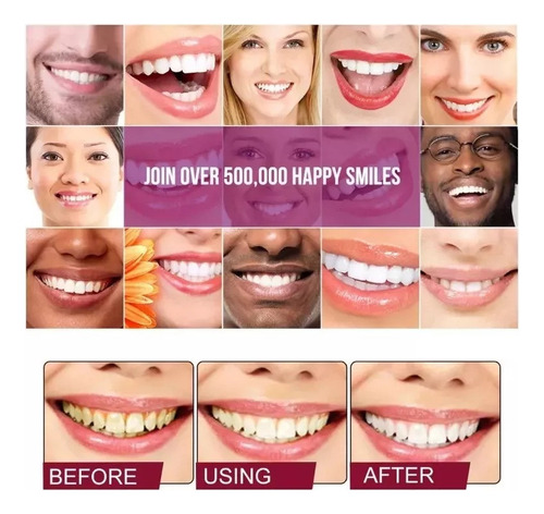 Mox Pasta Dental Blanqueadora De Dientes, 4 Unidades,