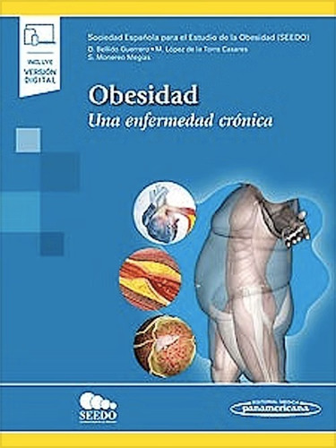 Obesidad Una Enfermedad Crónica - Seedo - Novedad