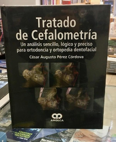 Libro - Tratado De Cefalometría, De Cesar A. Pérez Córdova.