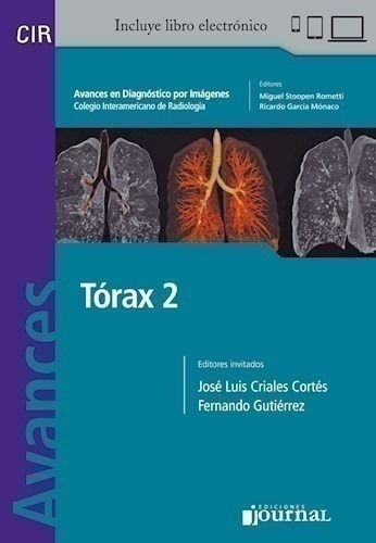 Avances En Diagnóstico Por Imágenes: Tórax 2 - Criales Cort