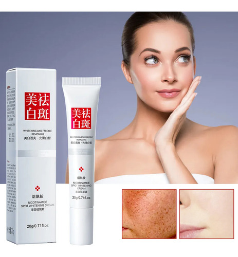 C Eliminador De Manchas Oscuras, Melasma, Pecas, Sol, Crema