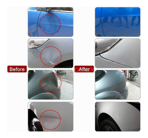 Kit Ventosa Saca Golpes Abolladuras Autos Carros Camionetas