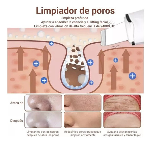 Limpiador Facial Ultrasónico 2 En 1 Con Exfoliador Blanco