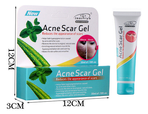 Q 35g Face Removal Cream Pimple Spots Scar Stretch Skin Care