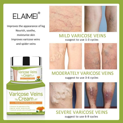 Crema For Venas P: Alivia El Dolor, Las Venas Y Las Protube-