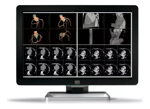 Barco Monitor Medico Coronis Fusion 6mp Led