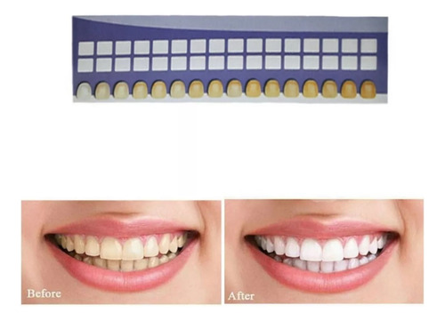 Blanqueador Dental Whitening Oral Gel 44% Peroxido Premium