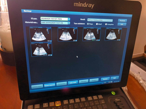 Ecógrafo Mindray Z60 + Transductor Microconvexo En Color. (Usado)