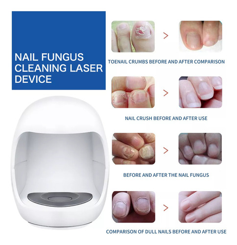 1x Máquina De Fototerapia De Uñas Para Eliminación De Hongos