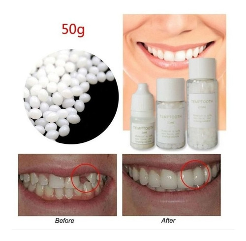 Imagen 2 de 8 de Kit De Reparación De Huecos De Dientes Postizos Temporales A