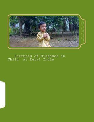 Libro Pictures Of Diseases In Child At Rural India - Dr R...