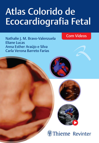 Atlas de Ecocardiografia Fetal, de Bravo-Valenzuela, Nathalie J. M.. Editora Thieme Revinter Publicações Ltda, capa dura em português, 2020