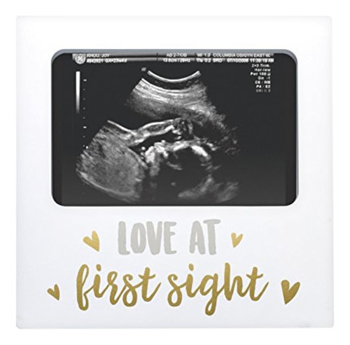 Tiny Ideas Love At First Sight Sonogram Keepsake Photo Frame