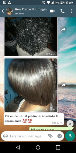 Imagen 1 de 7 de Cirugía Capilar Lo Mejor Para Tu Cabello