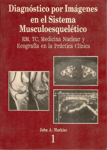 Libro Diagnostico Por Imagenes En El Sistema Musculoesquelet