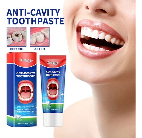 Pasta De Dientes Para Reducir La Caries Para La Limpieza Buc