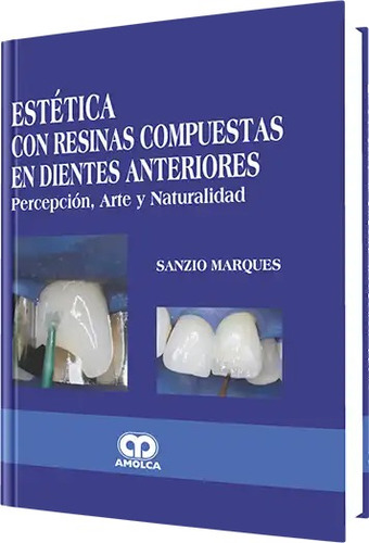 Estética Con Resinas Compuestas En Dientes Anteriores