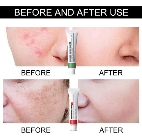 Crema Antipecas G Hidratante Antiarrugas Y Rejuvenecedora C