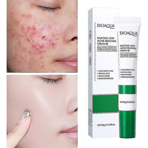Creme para pele oleosa com ácido salicílico Bioaqua