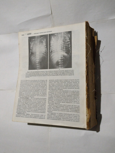 Tratado De Pediatria By Nelson (roto E Incompleto) Novena Ed