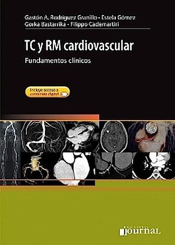 Tc Y Rm Cardiovascular - Rodriguez Granillo, Gaston A