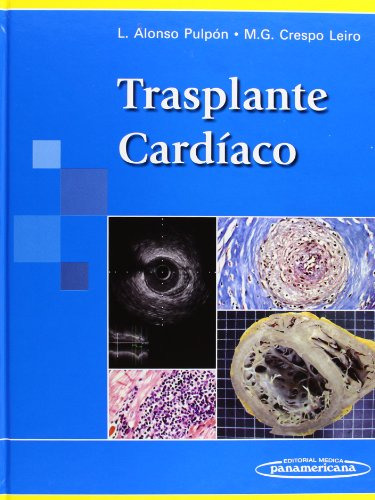 Libro Trasplante Cardiaco (cartone) - Alonso Pulpon / Crespo