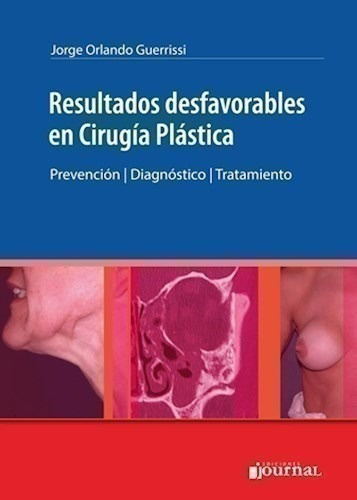 Resultados Desfavorables En Cirugía Plástica - Guerrissi, J