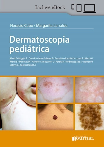 Dermatoscopia Pediátrica Journal