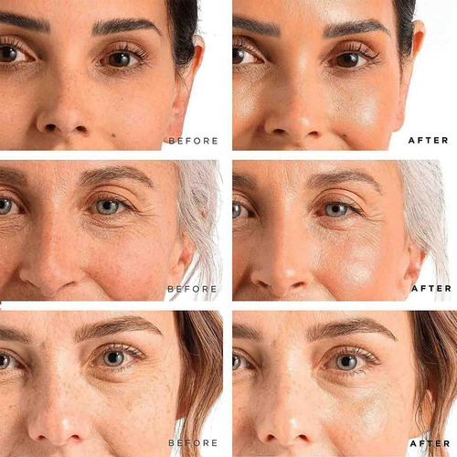 Luminaskin Age Barrier Advanced Cream - Crema Facial Renova.
