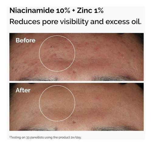 The Ordinary The Skin Support Set With Niacinamide + Hyaluro Todo Tipo De Piel Día/noche