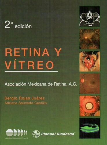 Retina Y Vítreo Rojas Juárez
