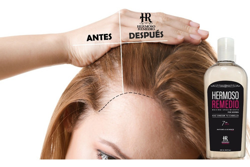 Imagen 2 de 5 de 2 Shampoo Anticaida Crecimiento Acelerado Hidratante 7 En 1