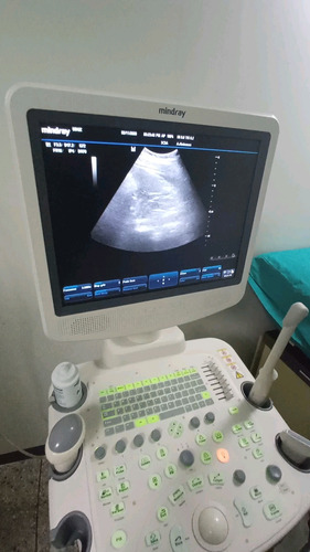 Imagen 1 de 5 de Reparamos Ecografos