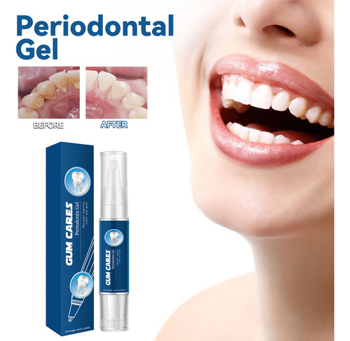 O Gel Blanqueador Dental Para Reducir Las Manchas Amarillas
