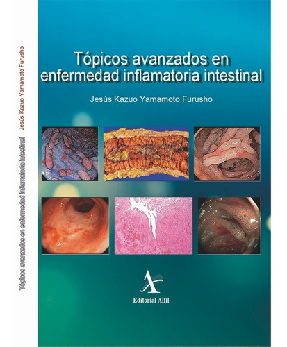 Tópicos Avanzados En Enfermedad Inflamatoria Intestinal